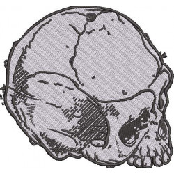 Cracked Skull